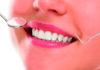 Blanqueamiento dental, la opción perfecta para lucir una bonita sonrisa